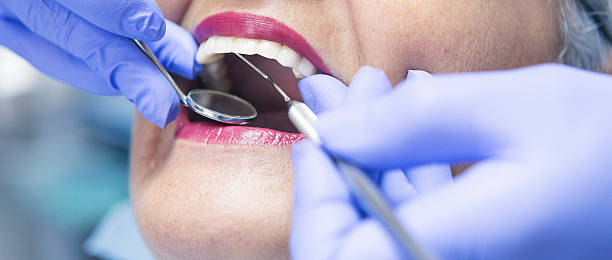 Best Broken Tooth Emergency  in Webster, FL